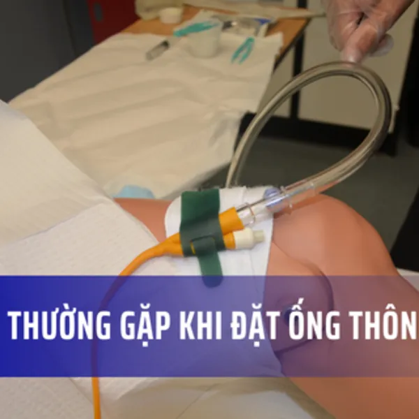 Những câu hỏi thường gặp khi sử dụng ống thông tiểu Foley
