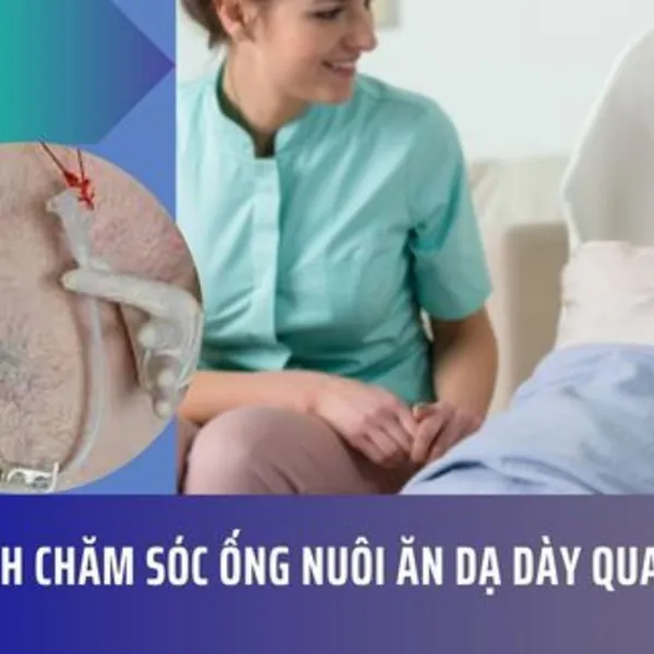 Cách Chăm Sóc Ống Nuôi Ăn dạ dày qua da