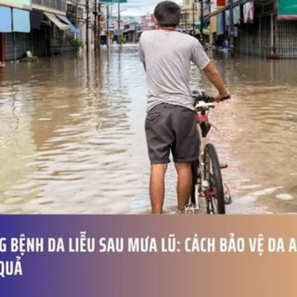 Phòng Bệnh Da Liễu Sau Mưa Lũ: Cách Bảo Vệ Da An Toàn Hiệu Quả