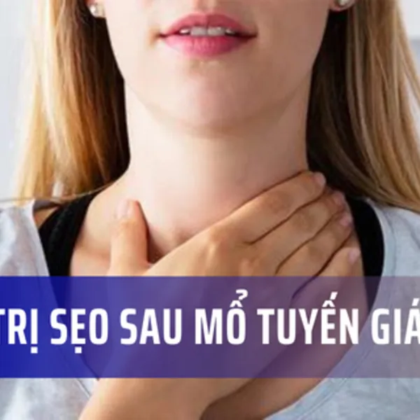 Cách trị sẹo sau mổ tuyến giáp
