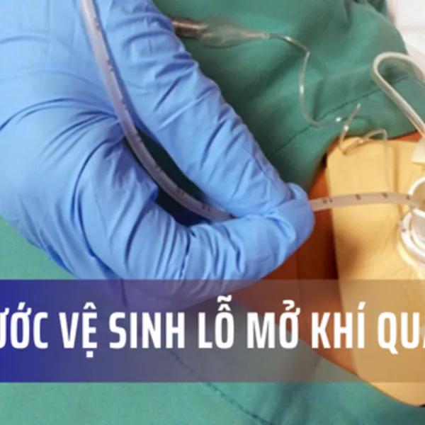 Các bước vệ sinh lỗ mở khí quản