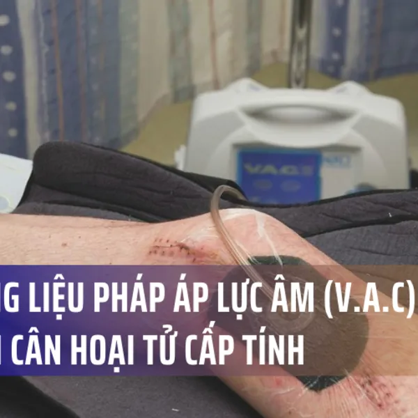 Thảo luận về ca bệnh ứng dụng liệu pháp áp lực âm (V.A.C) để điều trị viêm cân hoại tử cấp tính