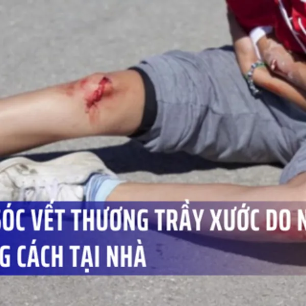 CHĂM SÓC VẾT THƯƠNG TRẦY XƯỚC DO NGÃ XE ĐÚNG CÁCH TẠI NHÀ