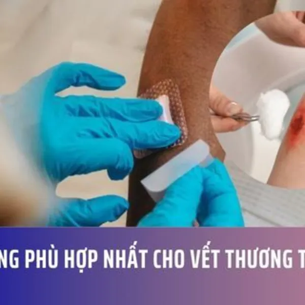 Loại băng phù hợp nhất cho vết thương tiết dịch