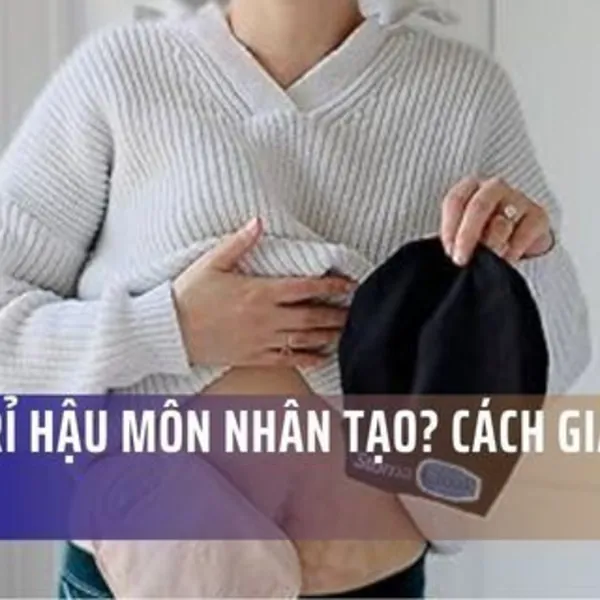 Sợ Rò Rỉ Hậu Môn Nhân Tạo? Cách Giải Quyết Từ Chuyên Gia Bệnh Viện Việt Đức
