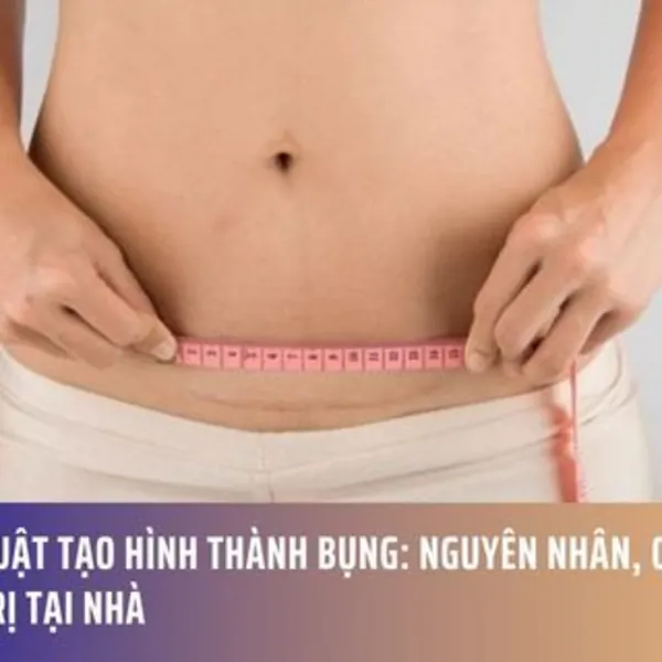 Phẫu Thuật Tạo Hình Thành Bụng: Nguyên Nhân, Quy Trình & Điều Trị Tại Nhà
