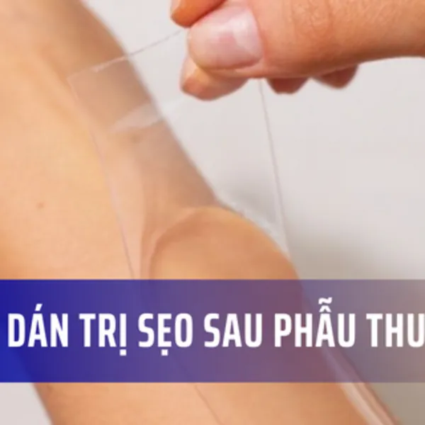 Miếng dán silicone xóa mờ sẹo sau phẫu thuật