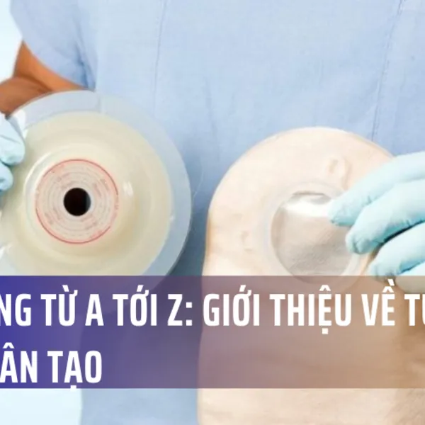 Cẩm nang từ A tới Z: Giới thiệu về túi hậu môn nhân tạo