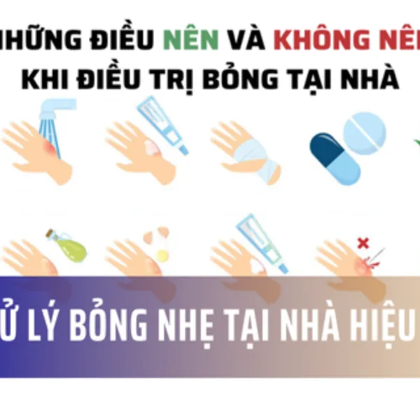 Cách trị bỏng tại nhà: Nên và không nên làm gì?