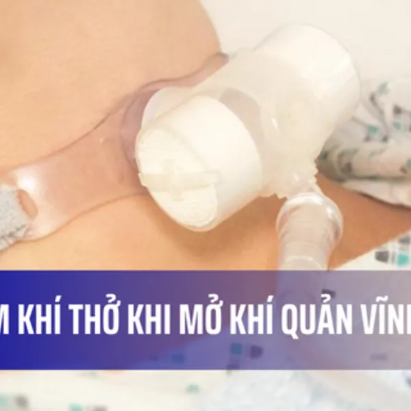 Tìm lại hơi ấm, khí ẩm khi khai khí quản vĩnh viễn