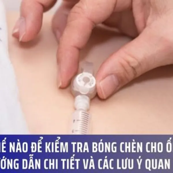 Làm thế nào để kiểm tra bóng chèn cho ống nuôi ăn mở thông dạ dày qua da? Hướng dẫn chi tiết và các lưu ý quan trọng