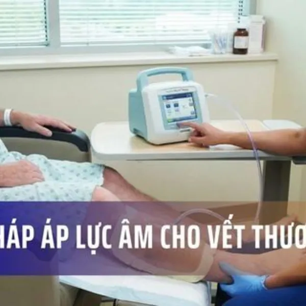 Liệu pháp áp lực âm cho vết thương
