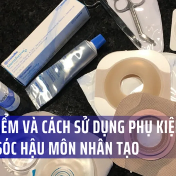Phụ kiện Hậu môn nhân tạo: Thời điểm và Cách sử dụng