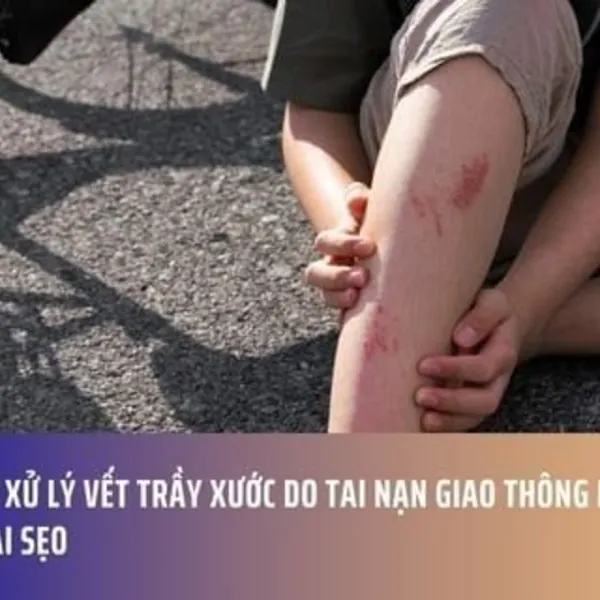 Cách Xử Lý Vết Trầy Xước Do Tai Nạn Giao Thông Không Để Lại Sẹo