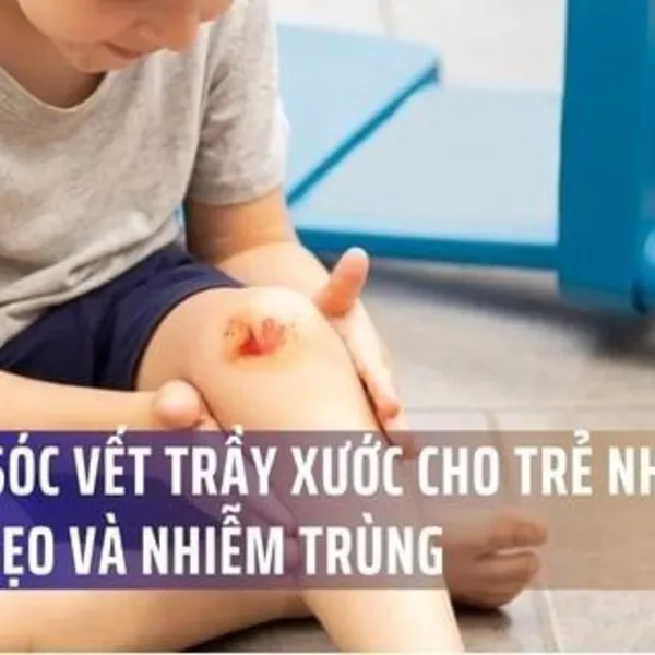 Chăm Sóc Vết Thương Trầy Xước Cho Trẻ Nhỏ Đúng Cách – Ngăn Sẹo Và Nhiễm Trùng Hiệu Quả