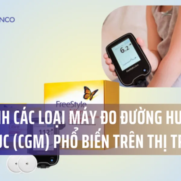 So sánh các loại máy đo đường huyết liên tục (CGM) phổ biến trên thị trường