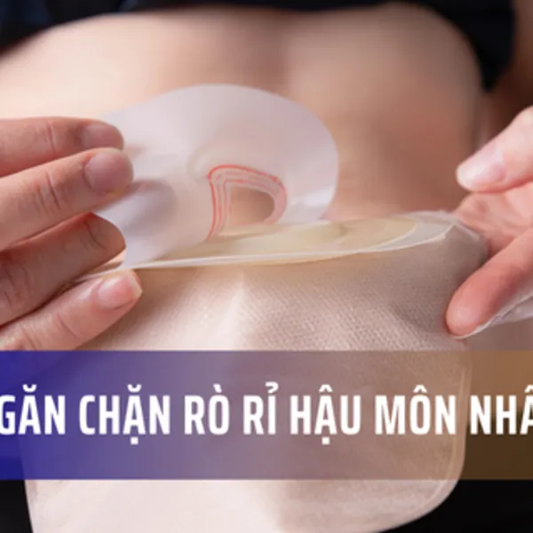 Các cách phòng tránh và ngăn chặn rò rỉ hậu môn nhân tạo