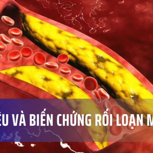 Dấu hiệu và biến chứng rối loạn mỡ máu
