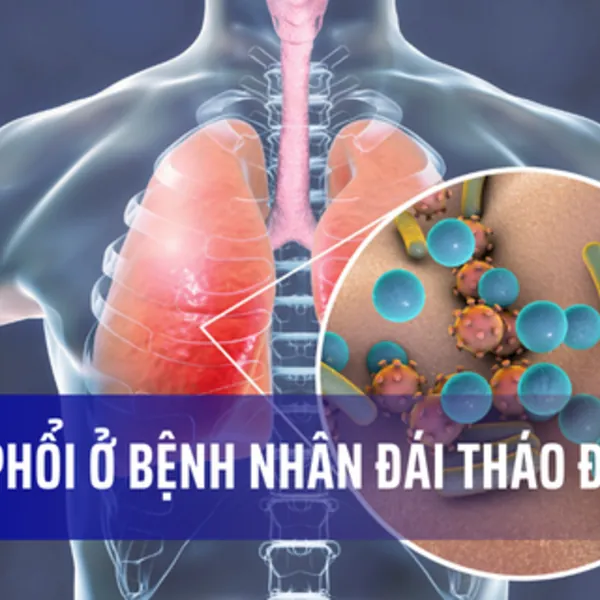 Viêm phổi ở bệnh nhân đái tháo đường