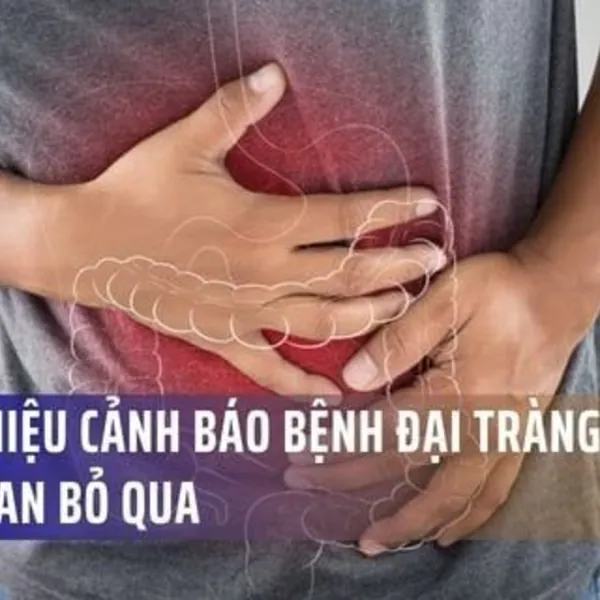 5 Dấu Hiệu Cảnh Báo Bệnh Đại Tràng Đừng Chủ Quan Bỏ Qua