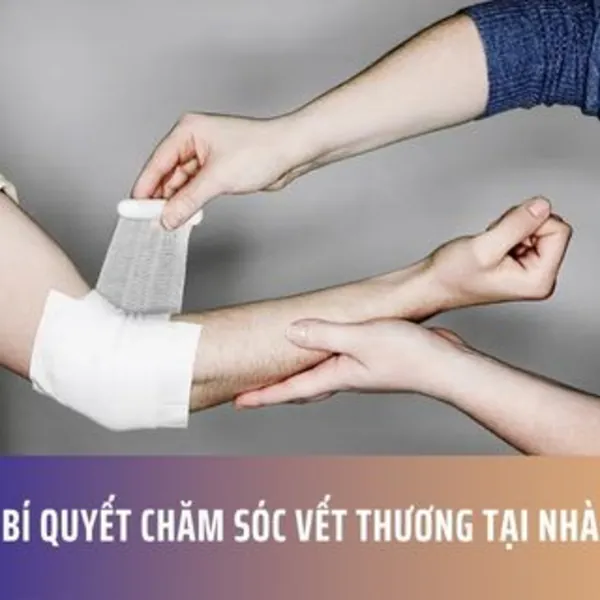 Bí Quyết Chăm Sóc Vết Thương Tại Nhà