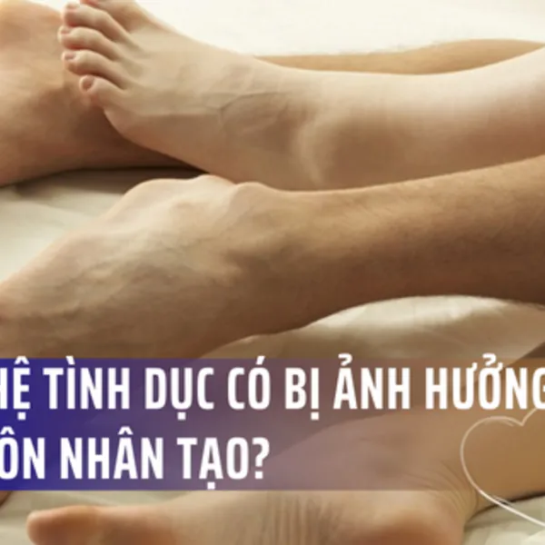 Quan hệ tình dục ở bệnh nhân có hậu môn nhân tạo: Những điều cần biết