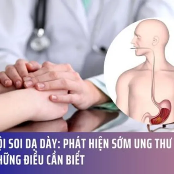 Nội soi dạ dày: Phát hiện sớm ung thư và những điều cần biết