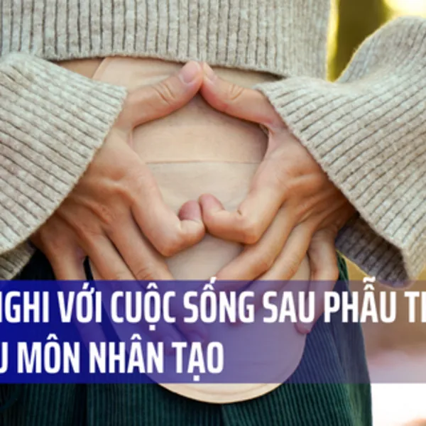 Thích nghi với cuộc sống sau phẫu thuật mở hậu môn nhân tạo (P2)