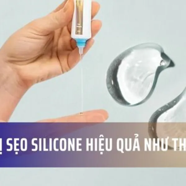 Kem trị sẹo silicone hiệu quả như thế nào?