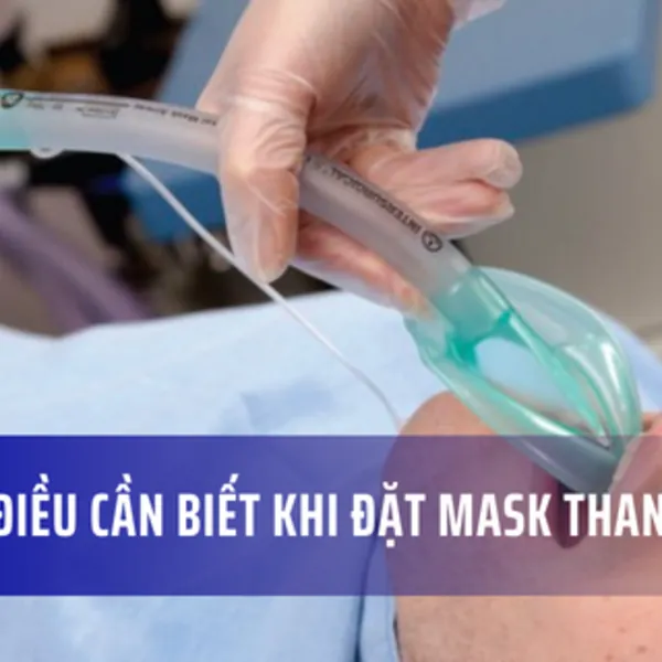 Những điều cần biết khi đặt mask thanh quản