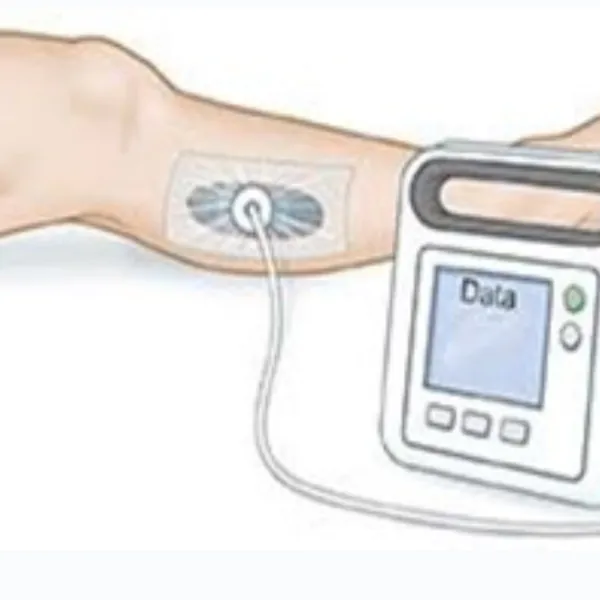 Các biến chứng tiềm ẩn của liệu pháp VAC vết thương