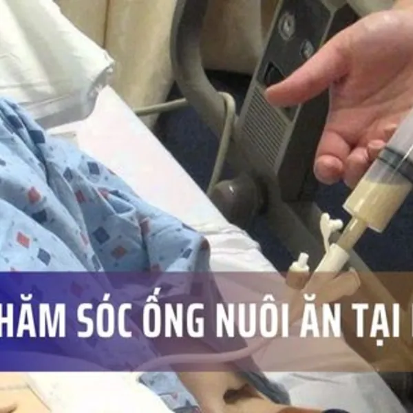 Mẹo chăm sóc ống nuôi ăn tại nhà