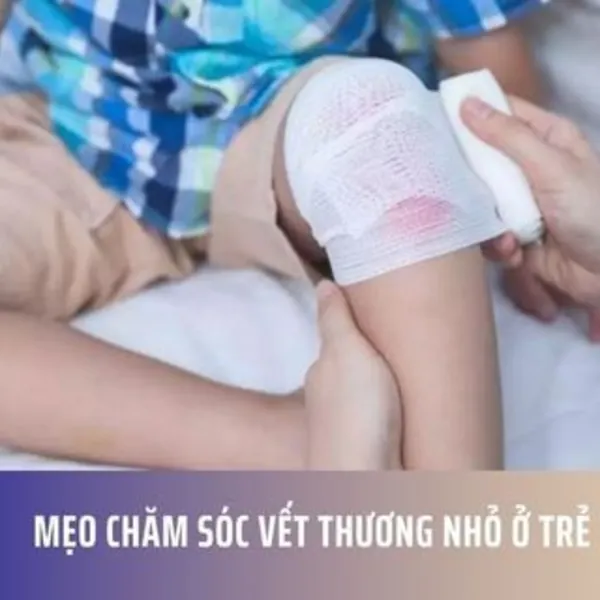 Mẹo Chăm Sóc Vết Thương Nhỏ Ở Trẻ