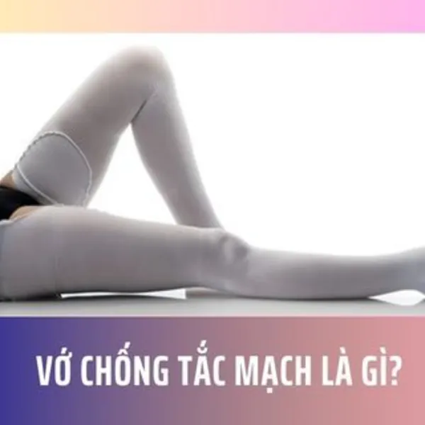 Vớ chống tắc mạch là gì?