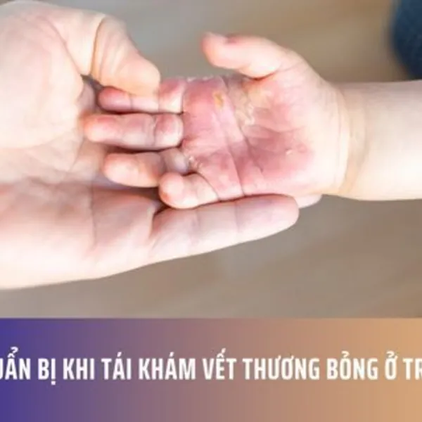 Chuẩn bị khi tái khám vết thương bỏng ở trẻ em