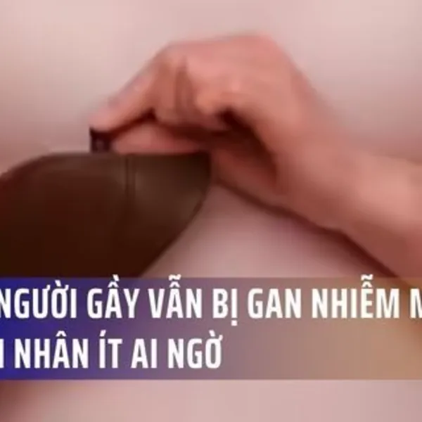 Vì Sao Người Gầy Vẫn Bị Gan Nhiễm Mỡ? Nguyên Nhân Ít Ai Ngờ