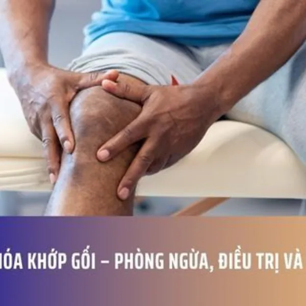 THOÁI HÓA KHỚP GỐI – PHÒNG NGỪA, ĐIỀU TRỊ VÀ QUẢN LÝ