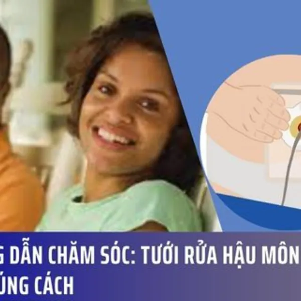 Hướng Dẫn Chăm Sóc: Tưới Rửa Hậu Môn Nhân Tạo Đúng Cách