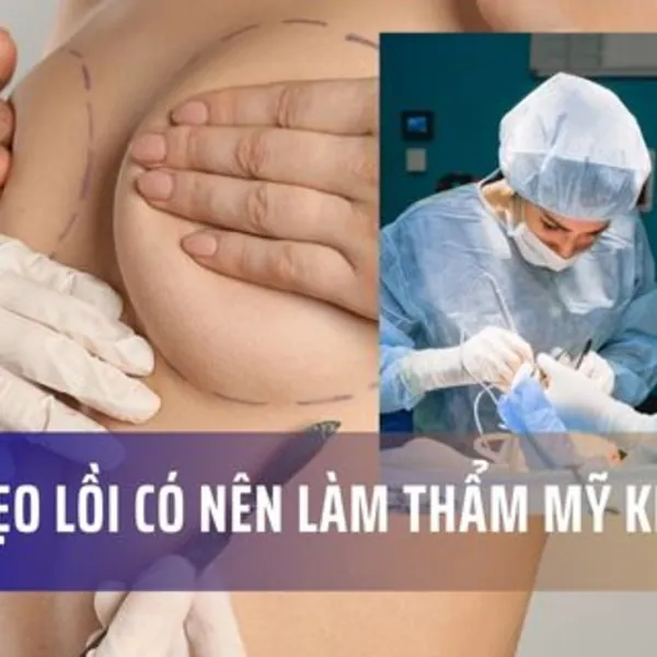 Dễ bị sẹo lồi có nên phẫu thuật thẩm mỹ không?