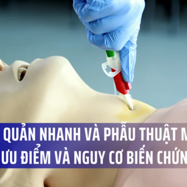 So sánh thủ thuật mở khí quản nhanh qua da và phẫu thuật mở khí quản