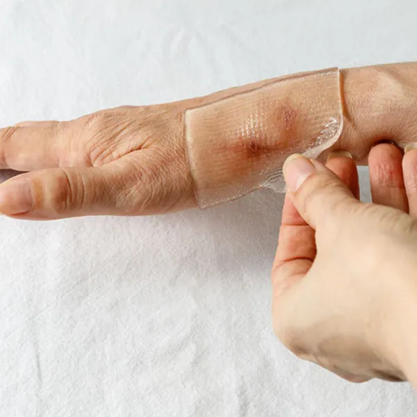 Chăm sóc vết sẹo sau phẫu thuật da