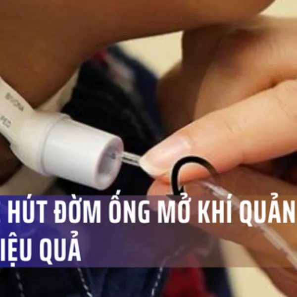 9 bước hút đờm canuyn mở khí quản đơn giản hiệu quả