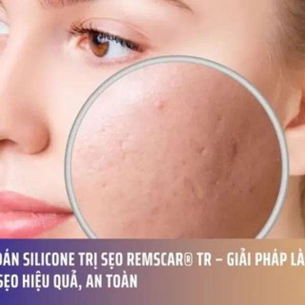 Miếng dán silicone trị sẹo RemScar® TR – Giải pháp làm mờ và phẳng sẹo hiệu quả, an toàn