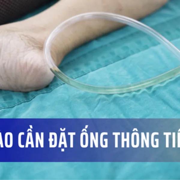 Khi nào cần đặt ống thông tiểu?