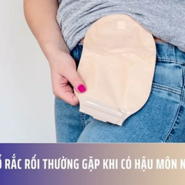 Một số rắc rối thường gặp khi có hậu môn nhân tạo