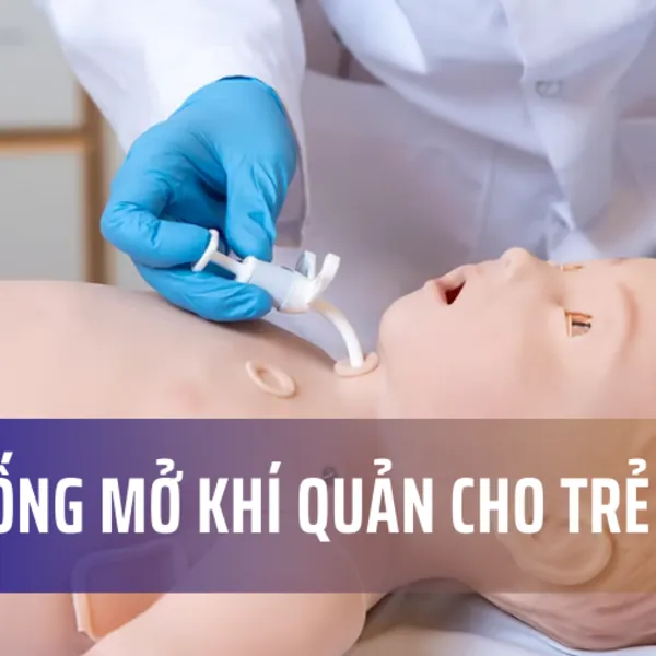 Thay Ống Mở Khí Quản Cho Trẻ