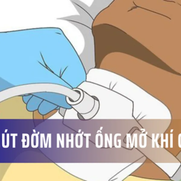 Hướng dẫn hút đờm ống mở khí quản bằng dây hút nhớt