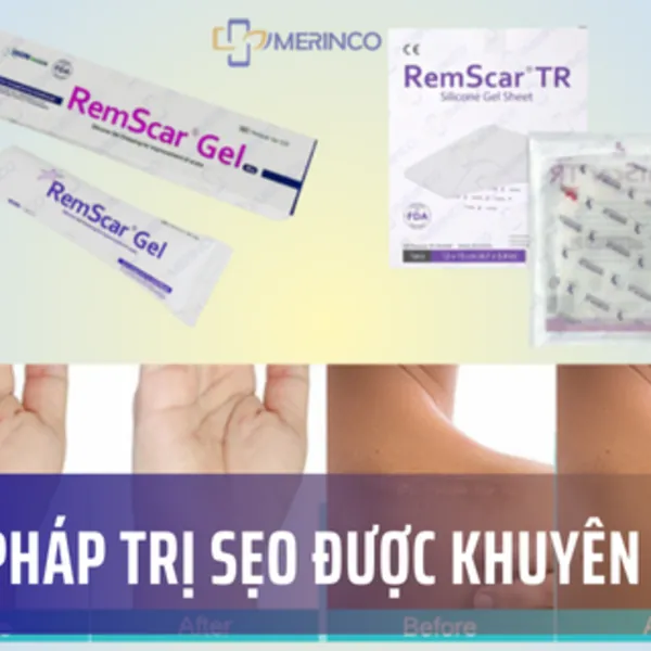 Giải Pháp Trị Sẹo Được Khuyên Dùng – Làn Da Hoàn Hảo Ngay Tại Nhà
