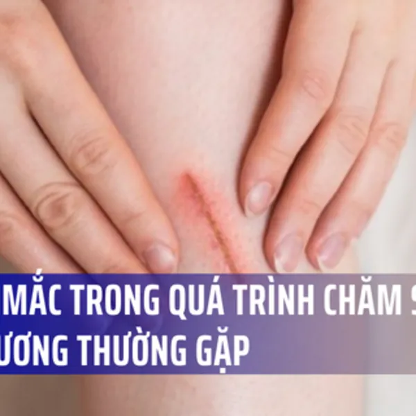 5 thắc mắc trong quá trình chăm sóc vết thương thường gặp