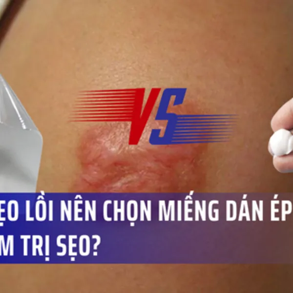 Miếng dán sẹo silicone vs. Gel sẹo silicone: Loại nào tốt hơn cho sẹo lồi?